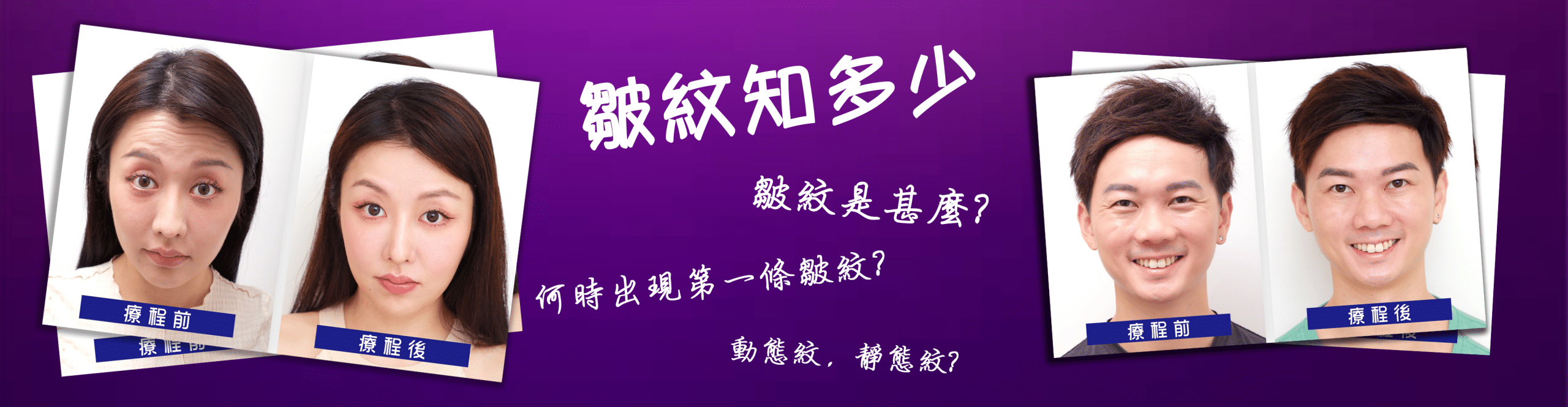 四張面部療程前後的對比圖片，左側為療程前的表情，右側為療程後，顯示出明顯的改善和年輕化效果。背景有關於皺紋和療程的問題，吸引觀眾的注意。