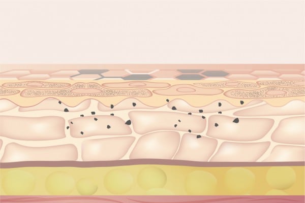 Medlite C6 納米激光機的廣告圖，強調其美國FDA認證，並標示其強效與安全性，適合用於美容及皮膚治療的推廣。