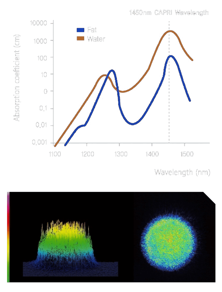 顯示1450nm波長下，脂肪與水的吸收係數圖表，展示不同波長對皮膚的影響。