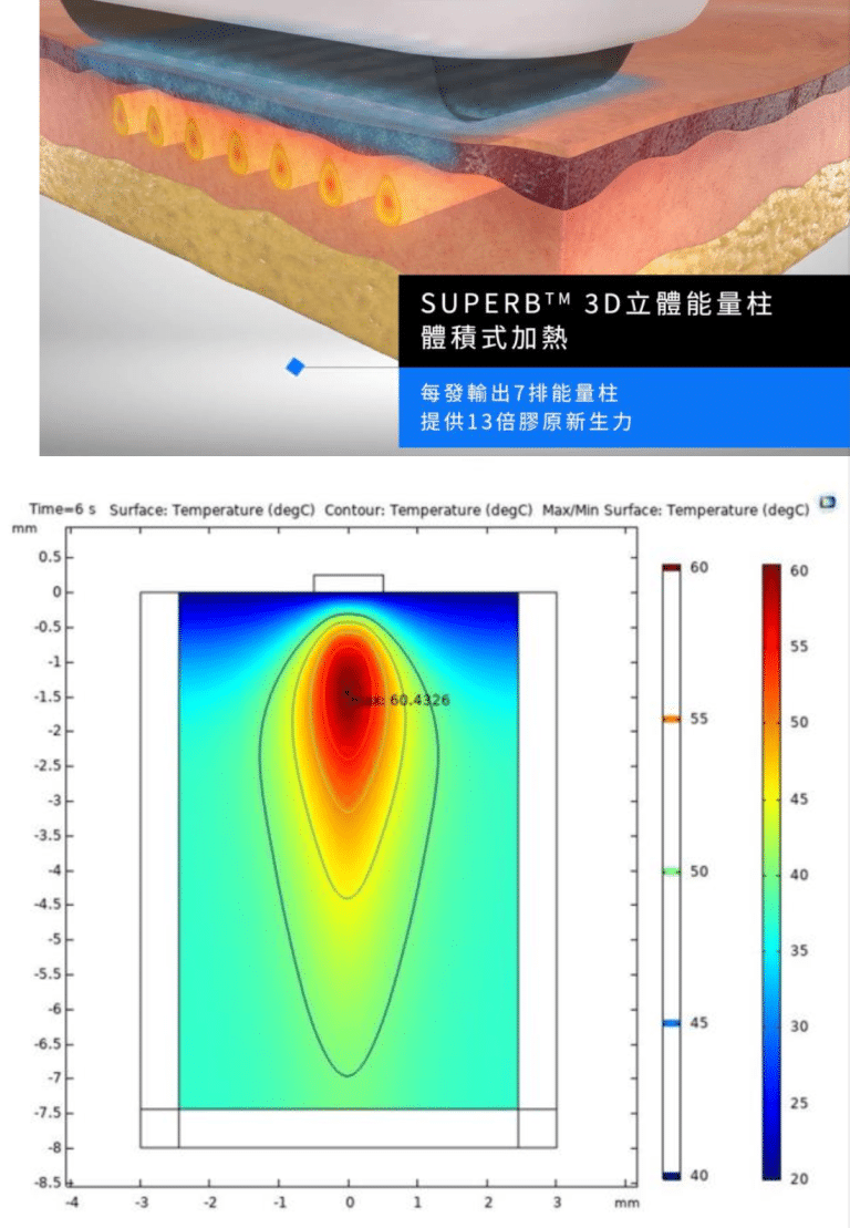 展示Sofwave™技術的3D立體體量柱加熱過程，顯示熱能分佈和溫度變化，強調其治療效果及創新性。