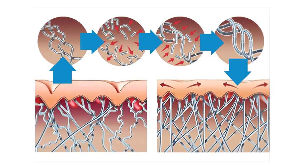 皮膚結構變化示意圖，展示膠原蛋白纖維的重組過程，強調皮膚緊實與修復的生物機制。