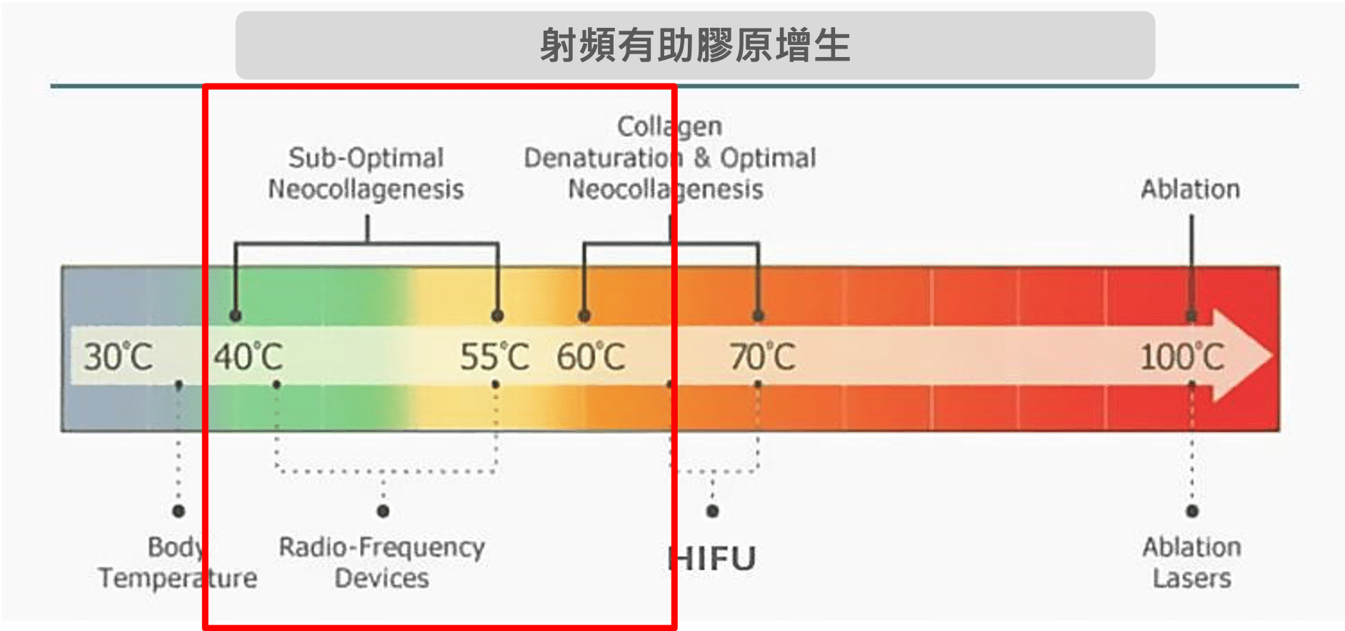 示意圖顯示不同溫度下的膠原蛋白增生過程，強調射頻美容技術在皮膚治療中的重要性，適合於教育與宣傳材料。