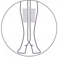 女性雙腿插圖，顯示小圓點美容貼片貼在小腿部位，強調腿部護理和美容產品的應用。